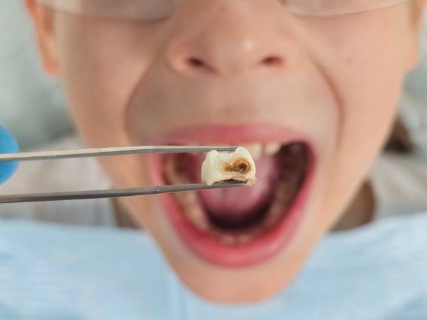Best Urgent Dental Care for Toothache in Athens, IL